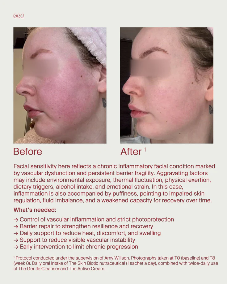1. Facial sensitivity