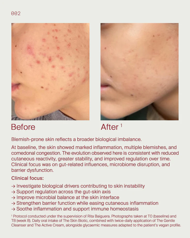 2. Blemish prone