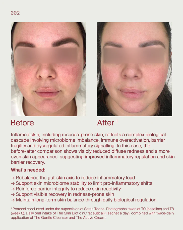 2. Inflamed Skin