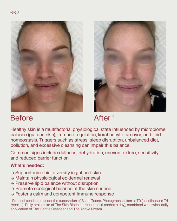 3. Healthy skin