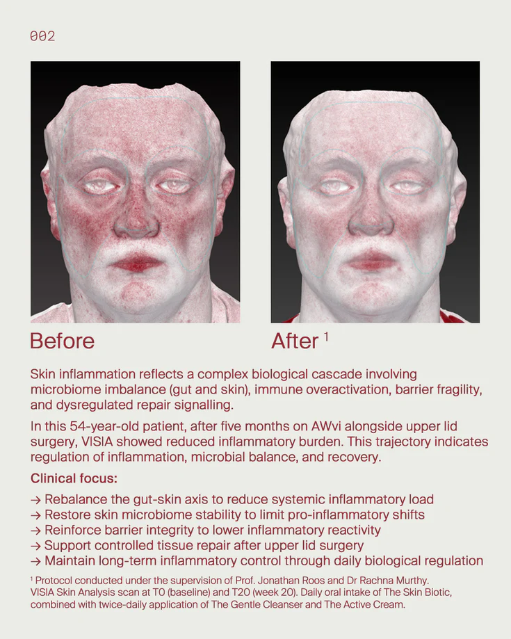 3. Inflammageing