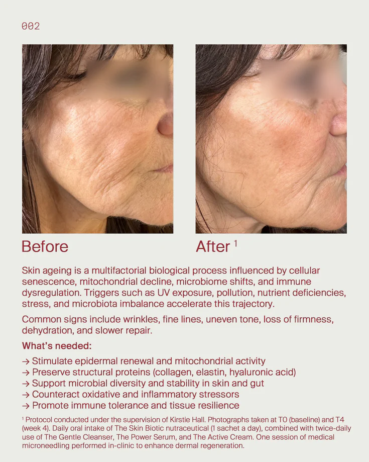 4. Ageing skin