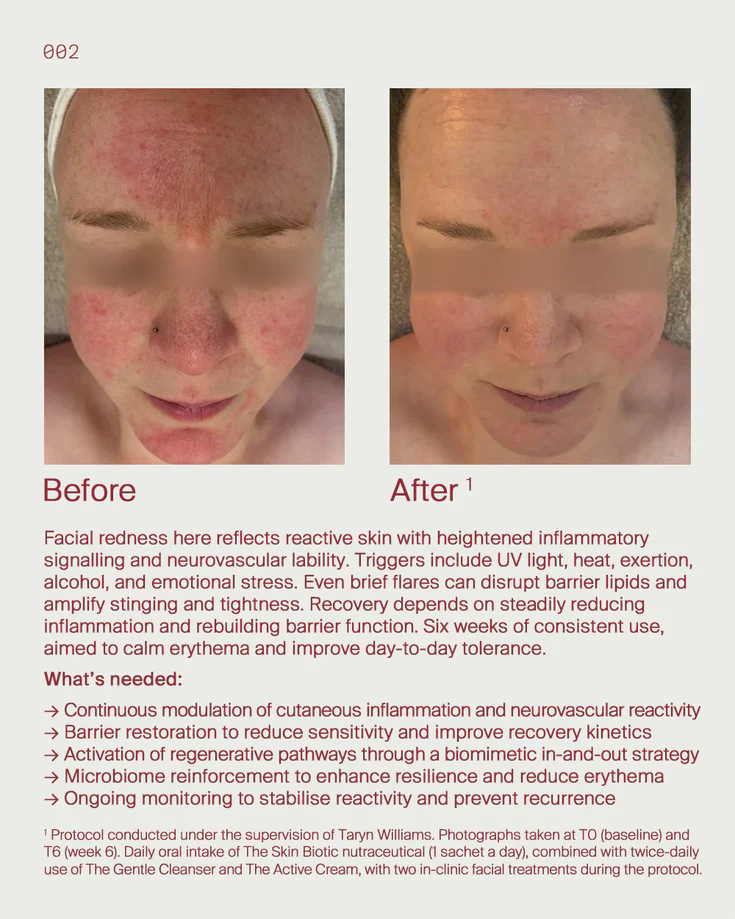4. Reactive skin