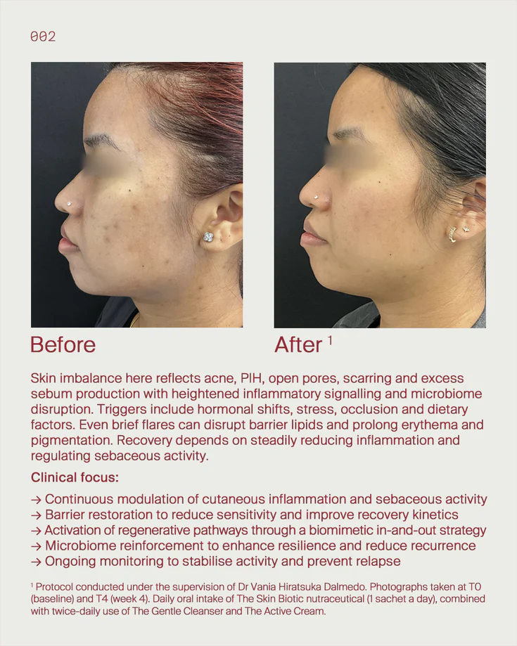 5. Skin imbalance