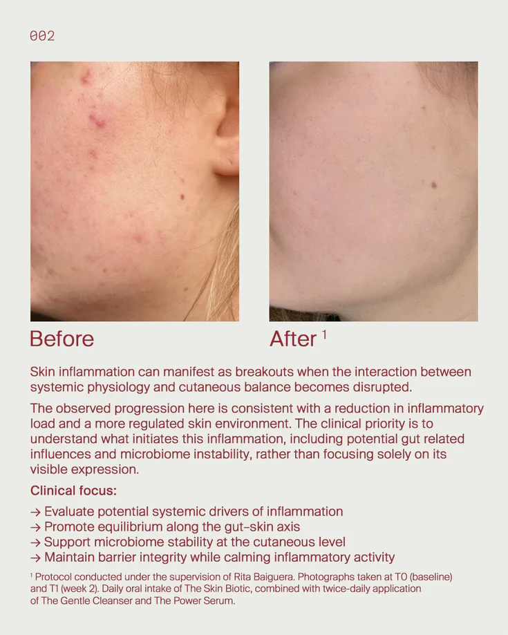 6. Skin inflammation