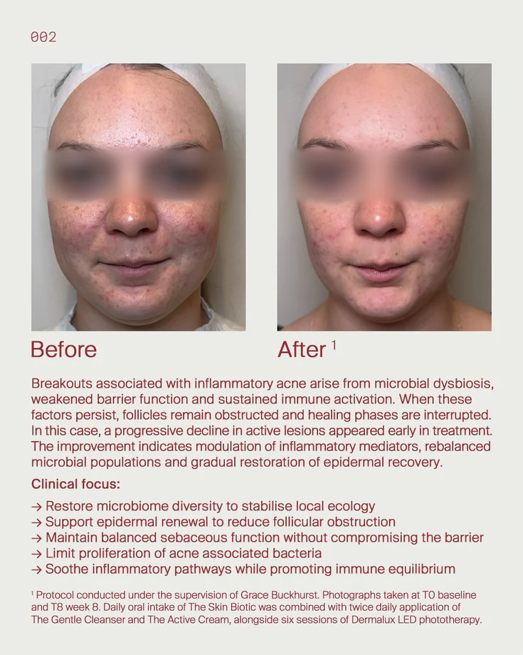 8. Breakouts