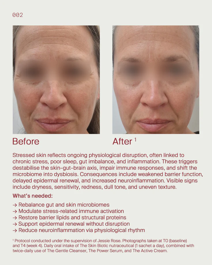 9. Stressed skin