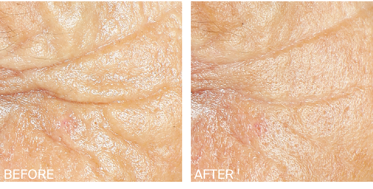 Ageing Before After