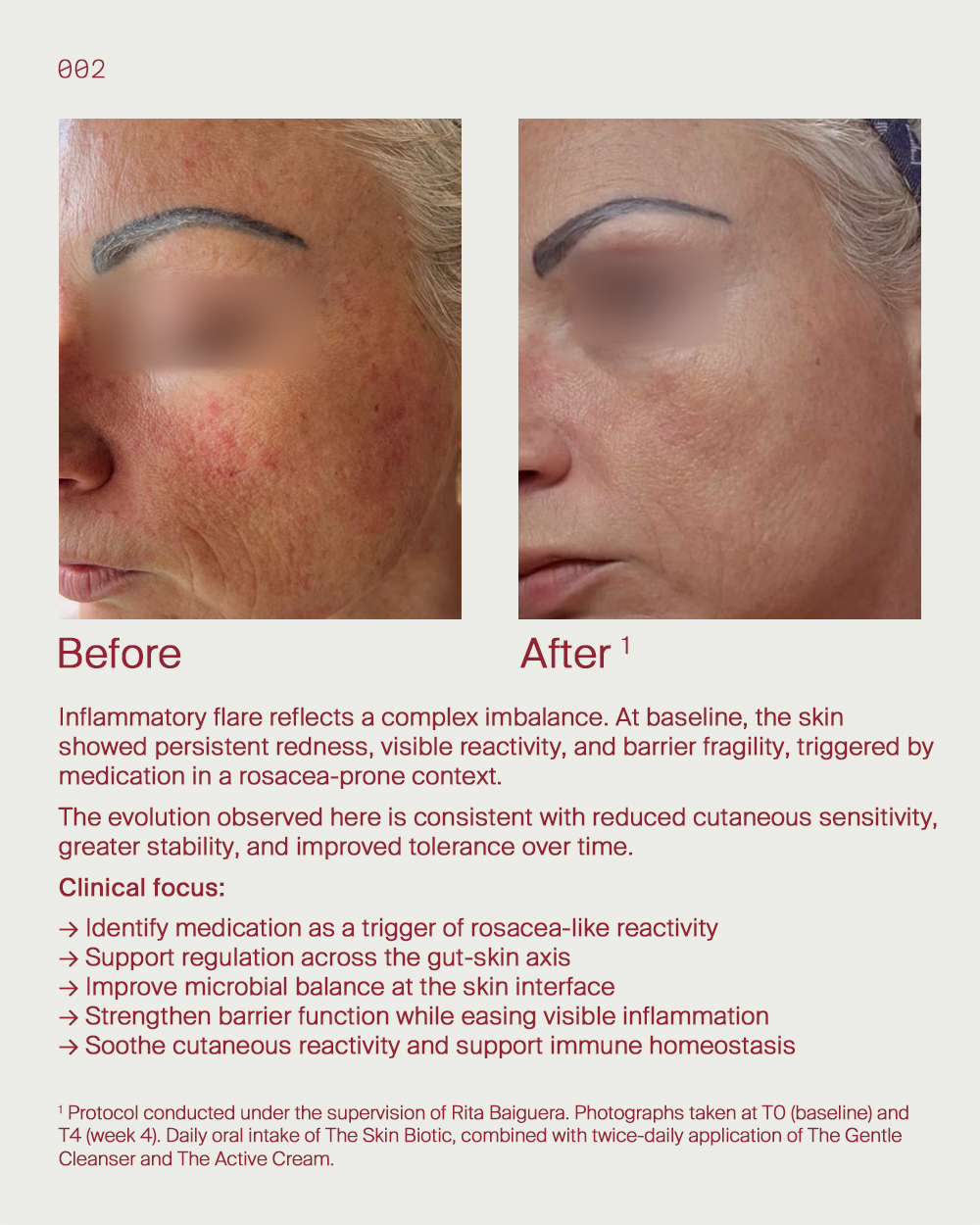 1. Inflammatory flare