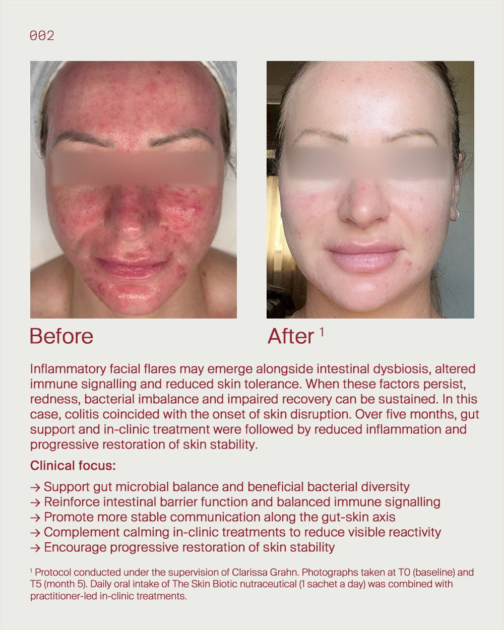 4. Gut skin flare